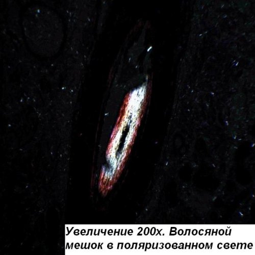 Микроскоп Optika B-150POL-B 40x-400x Bino Polarizing